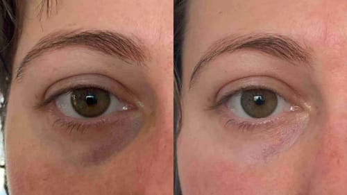 UNGdU42p-.jpg__PID:91188e48-b124-4327-98bd-43cfb7a19b4c