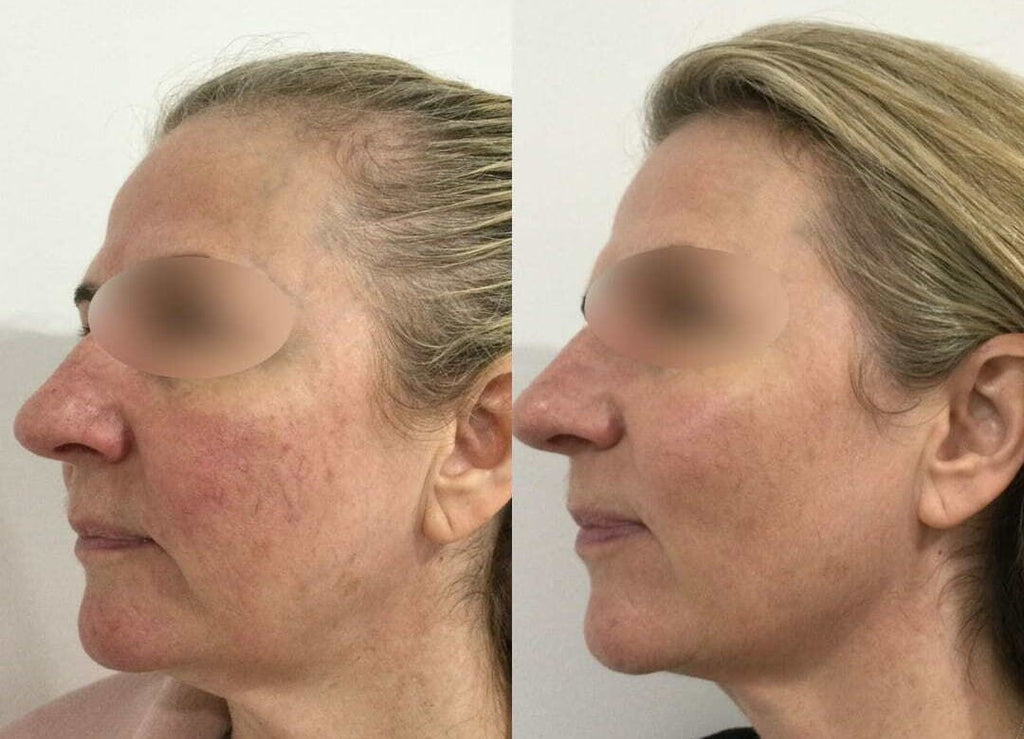 aHYXb85vK_mid.jpg__PID:7b0aca46-938a-438b-b8ae-f87d22da4f4b